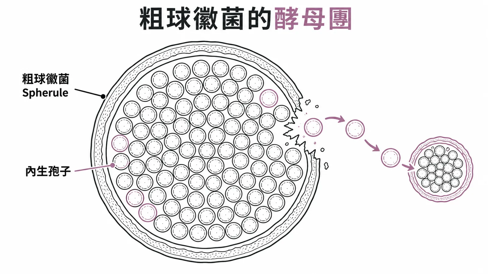 粗球黴菌Spherule剖面:厚壁球體內充滿內生孢子,破裂後釋出再生