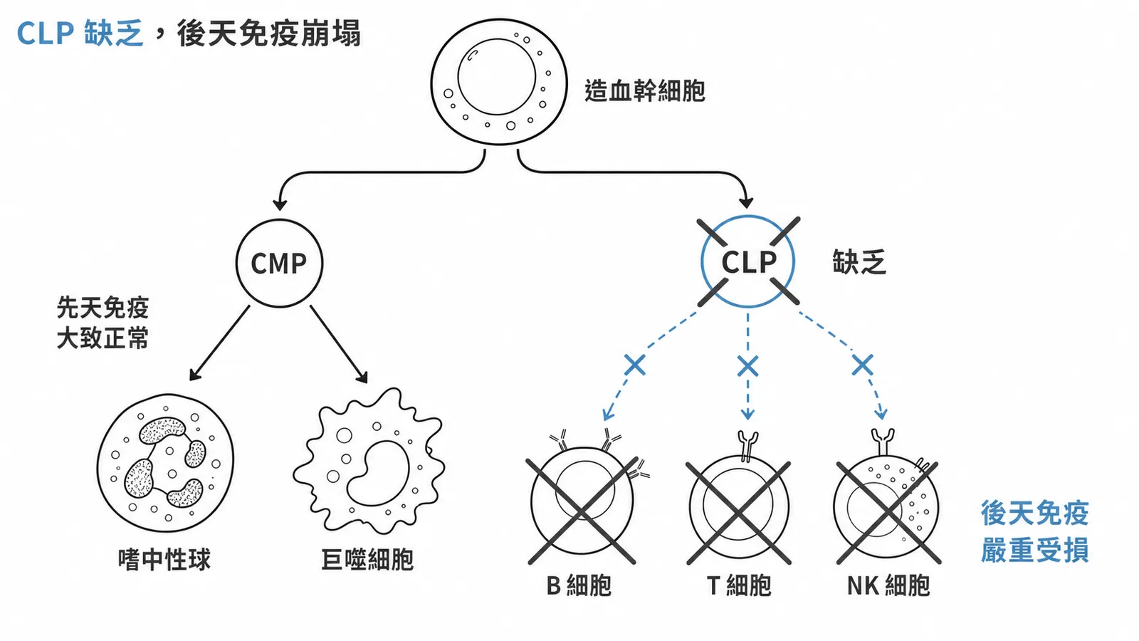CLP缺乏造成B/T/NK細胞全部缺失,後天免疫嚴重受損