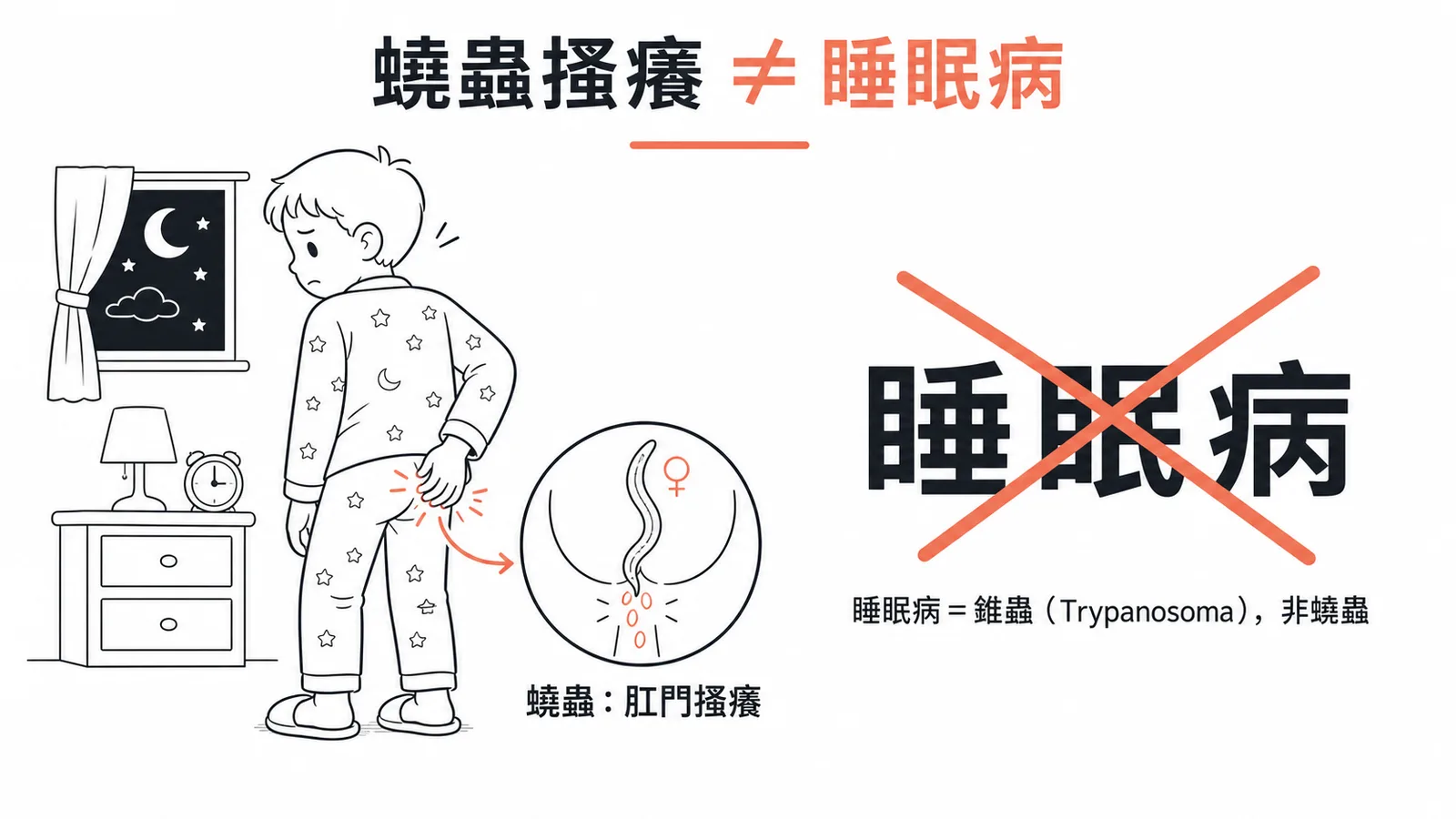 蟯蟲肛門搔癢與睡眠病區分示意圖