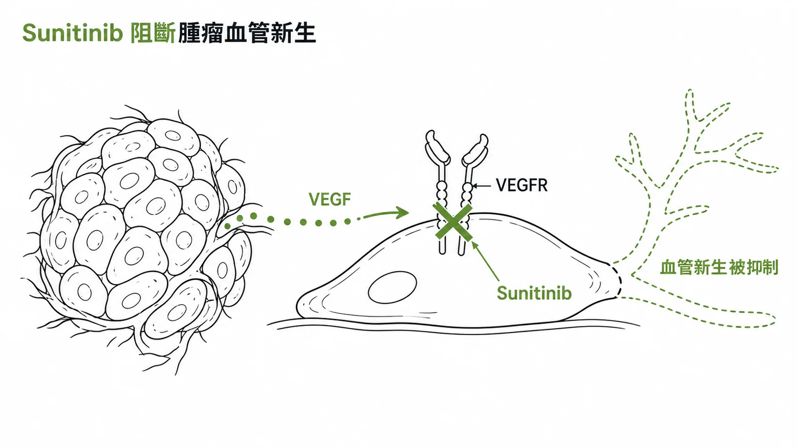 Sunitinib 阻斷 VEGFR 抑制腫瘤血管新生