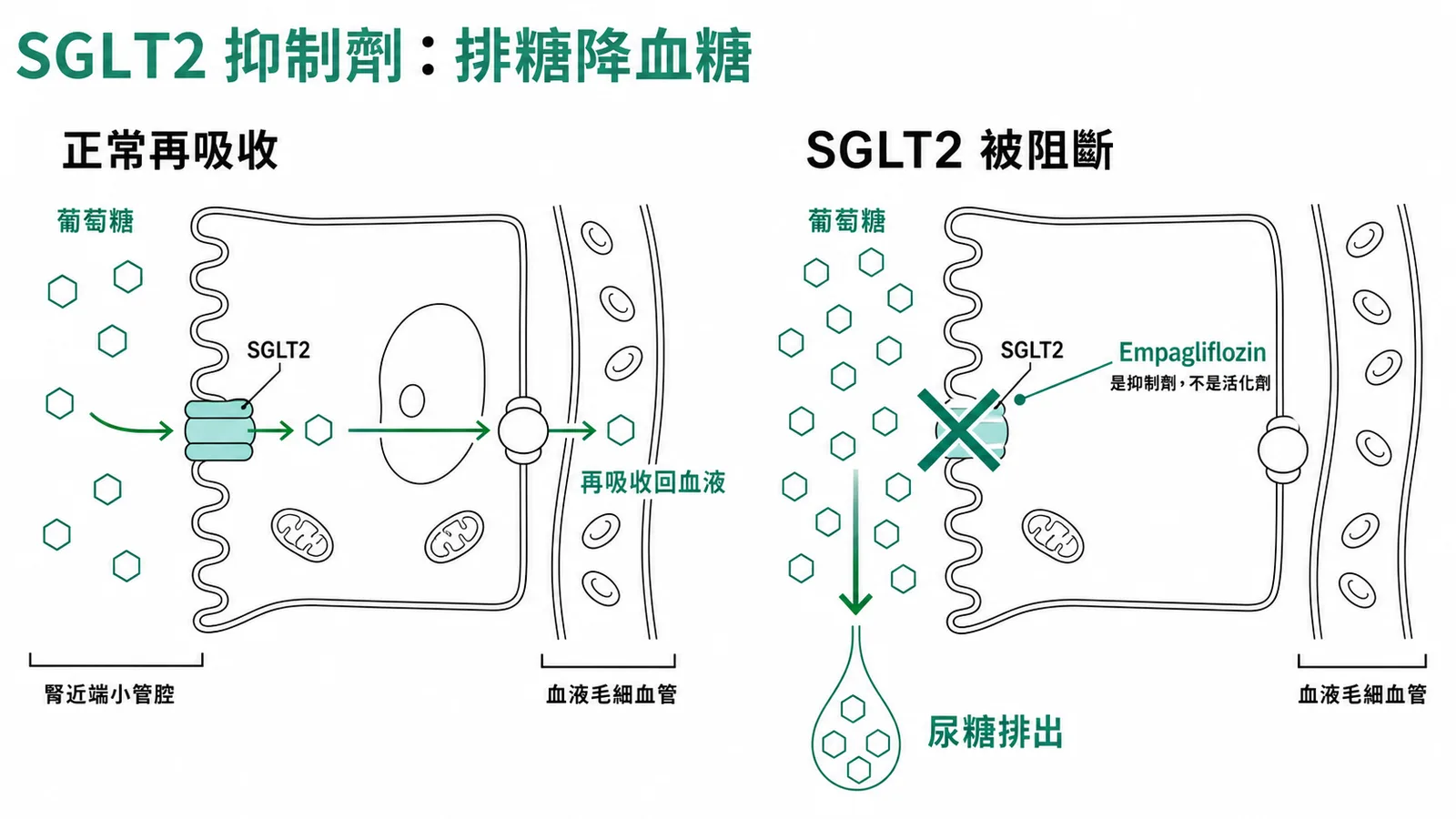SGLT2 抑制劑排糖降血糖機轉示意圖
