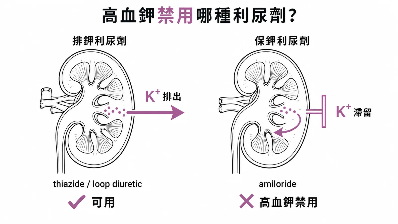 高血鉀禁用保鉀利尿劑:排鉀利尿劑可用、amiloride 禁用