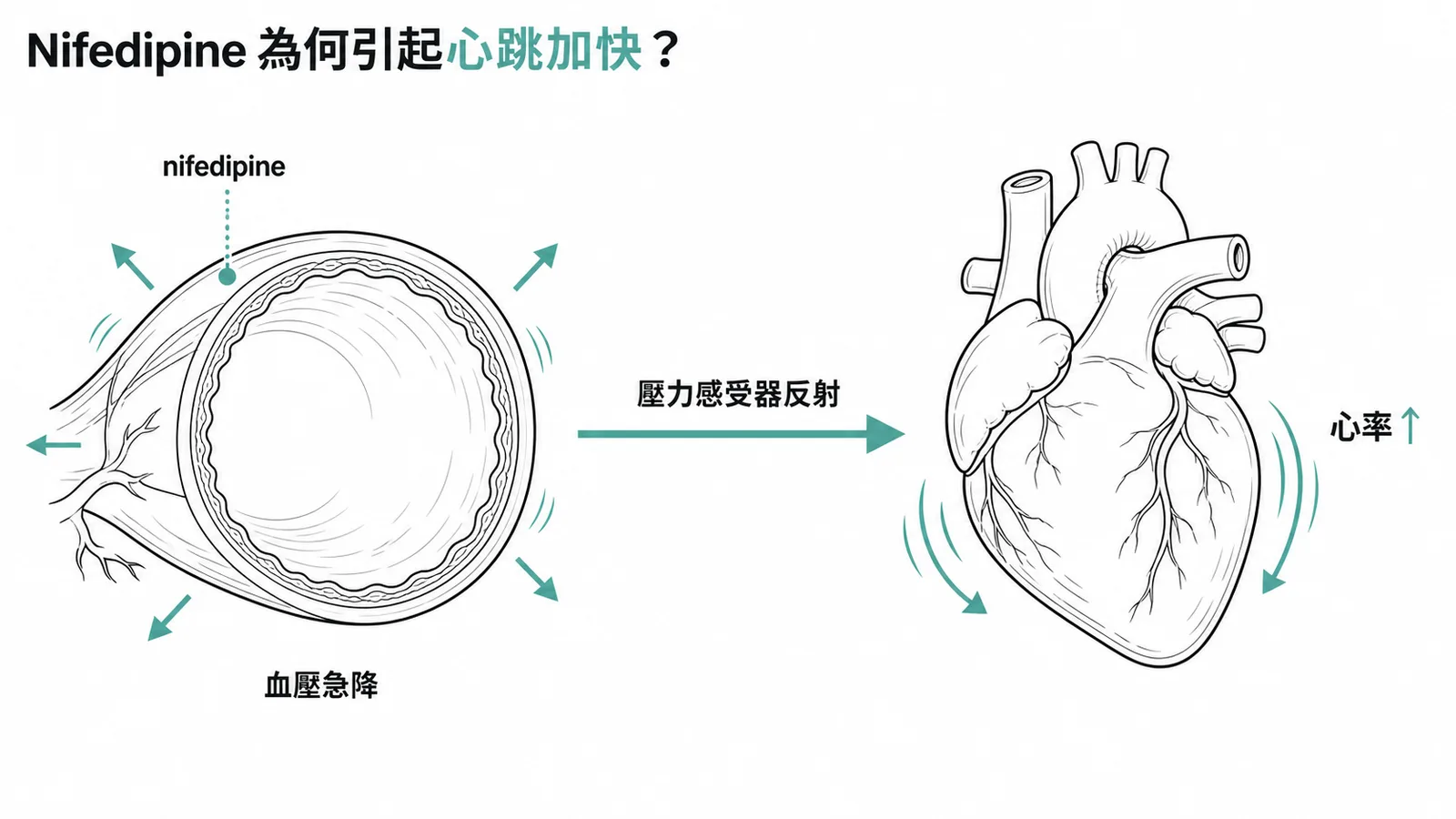 Nifedipine 快速擴張血管致血壓急降，壓力感受器反射使心率加快