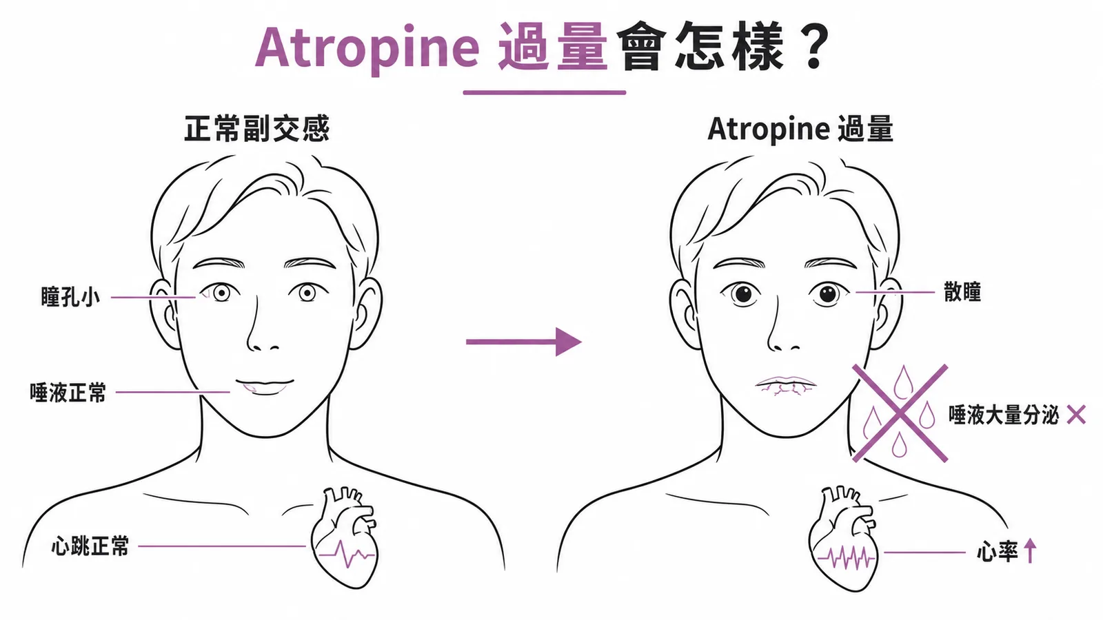 Atropine 過量的反副交感效應：散瞳、口乾、心率加快，唾液大量分泌不會出現