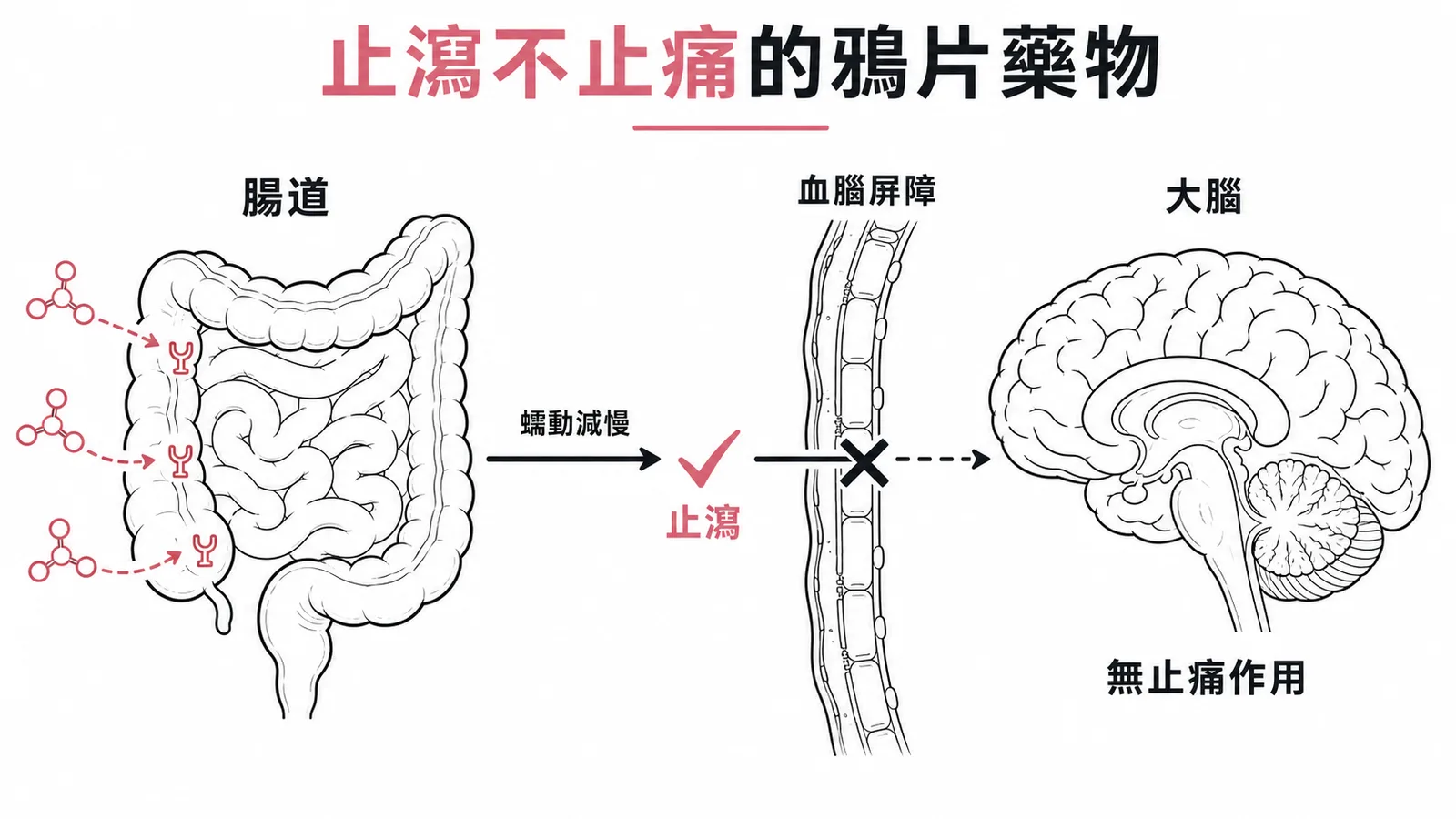 Loperamide 與 diphenoxylate 作用在腸道止瀉,無法通過血腦屏障故不止痛