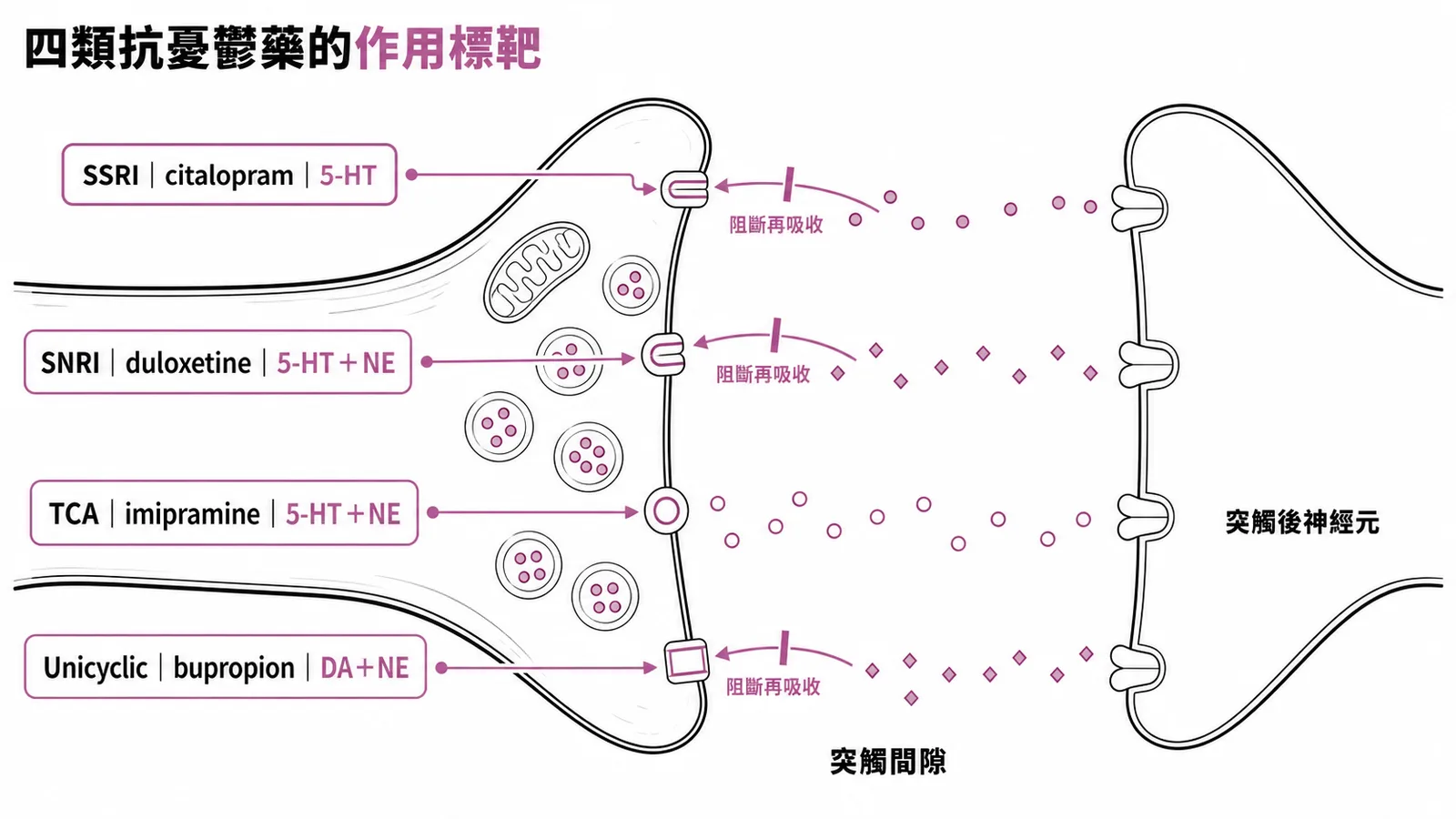 四類抗憂鬱藥物分別阻斷不同神經傳導物質再吸收的突觸示意圖