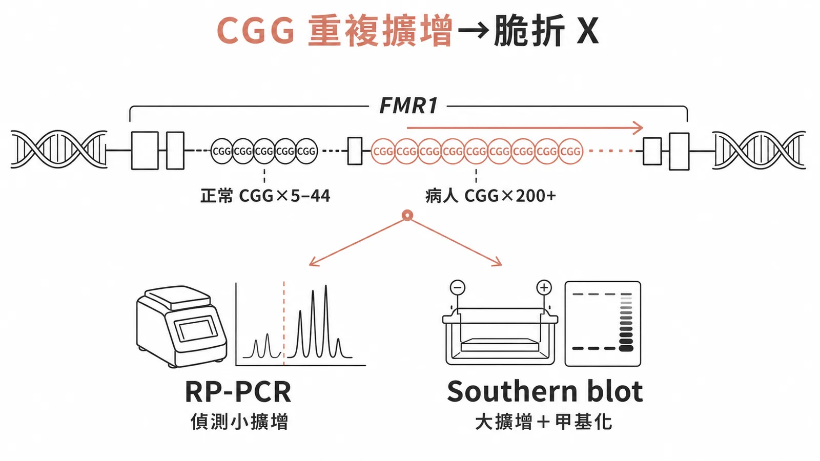 FMR1 基因 CGG 重複擴增與 RP-PCR 及 Southern blot 診斷示意圖