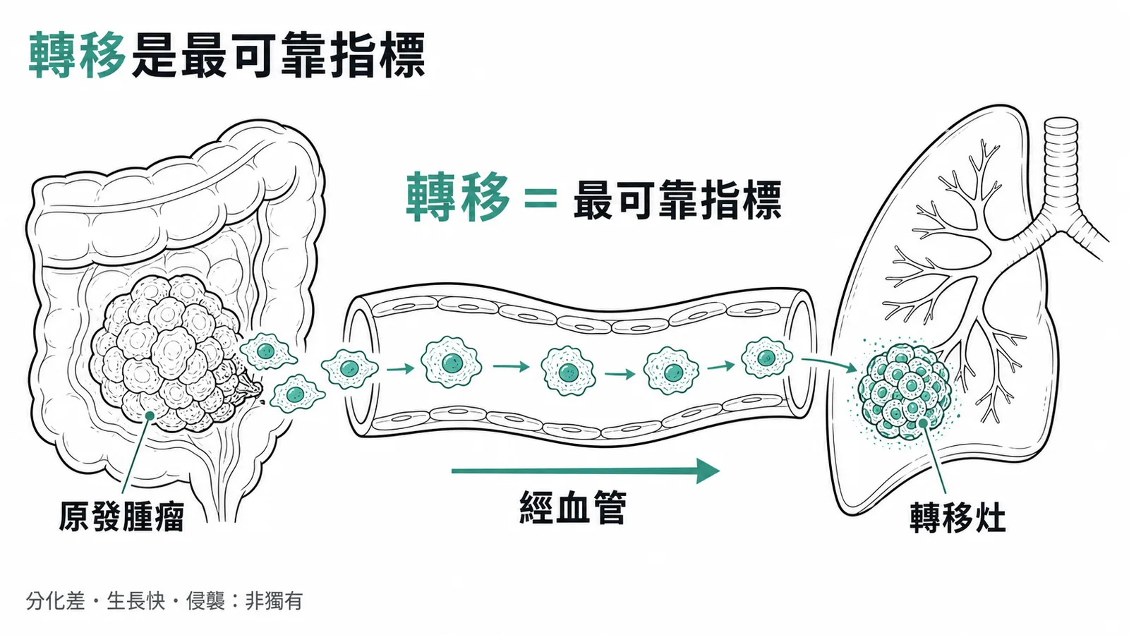 惡性腫瘤經血管轉移至遠端器官的示意圖，轉移是最可靠指標