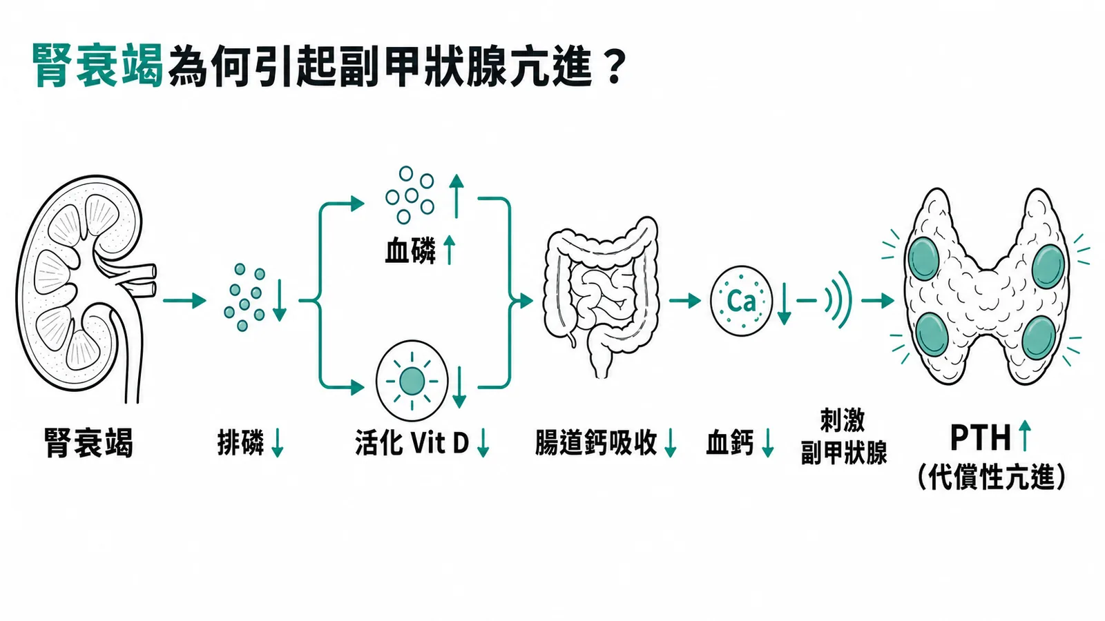 腎衰竭引起次發性副甲狀腺亢進的因果流程