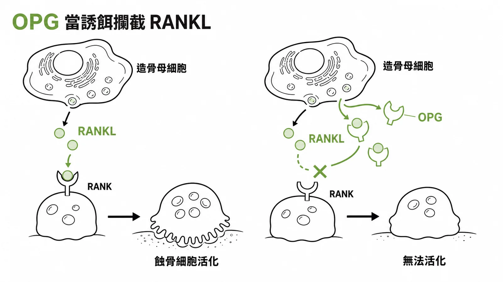 OPG當誘餌攔截RANKL阻止蝕骨細胞活化