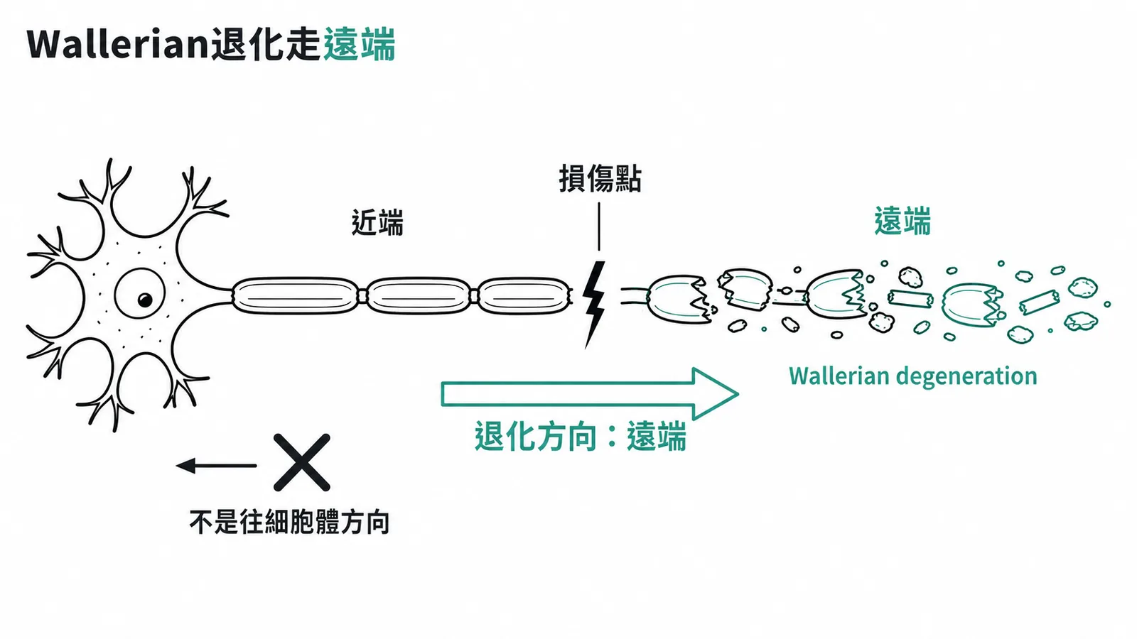 Wallerian退化走遠端：損傷處遠端髓鞘碎裂退化
