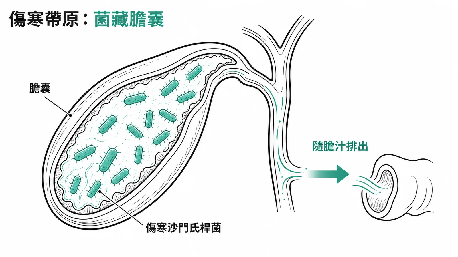 傷寒沙門氏桿菌在膽囊內定植並隨膽汁排出的示意圖