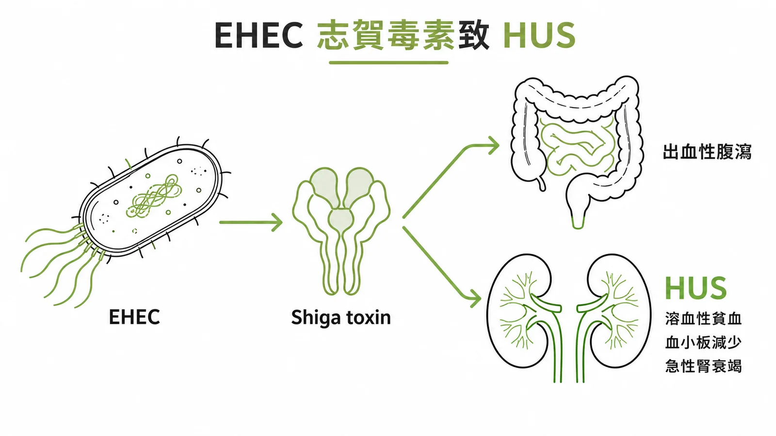 EHEC 產 Shiga toxin 導致出血性腹瀉與溶血性尿毒症的致病機轉