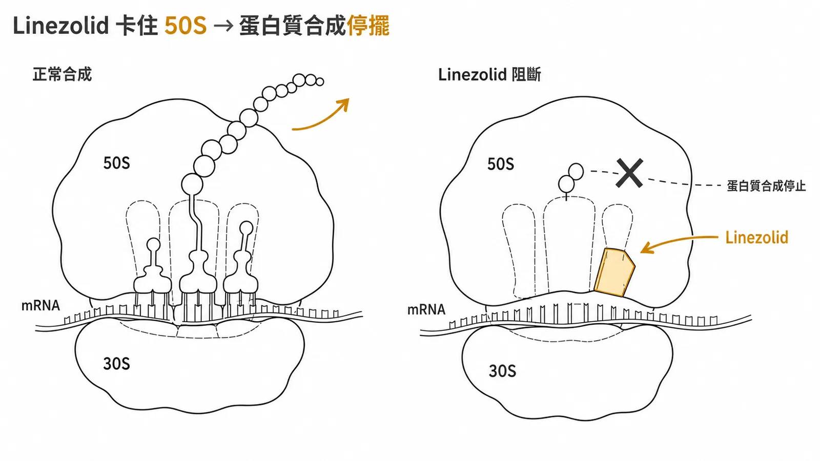 Linezolid結合50S核糖體亞基阻斷蛋白質合成