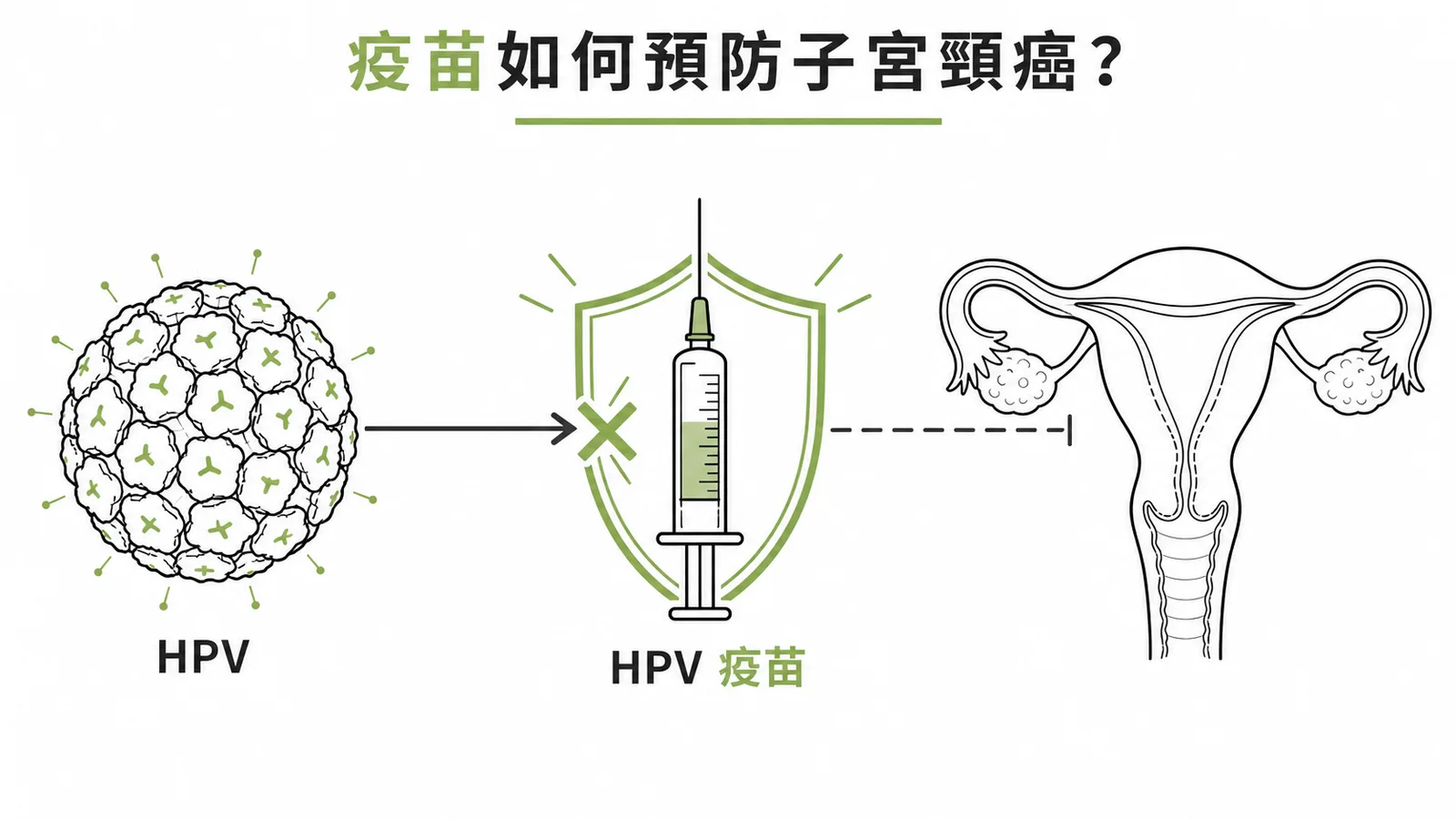 HPV 疫苗阻斷 HPV 病毒感染以預防子宮頸癌的機轉示意圖