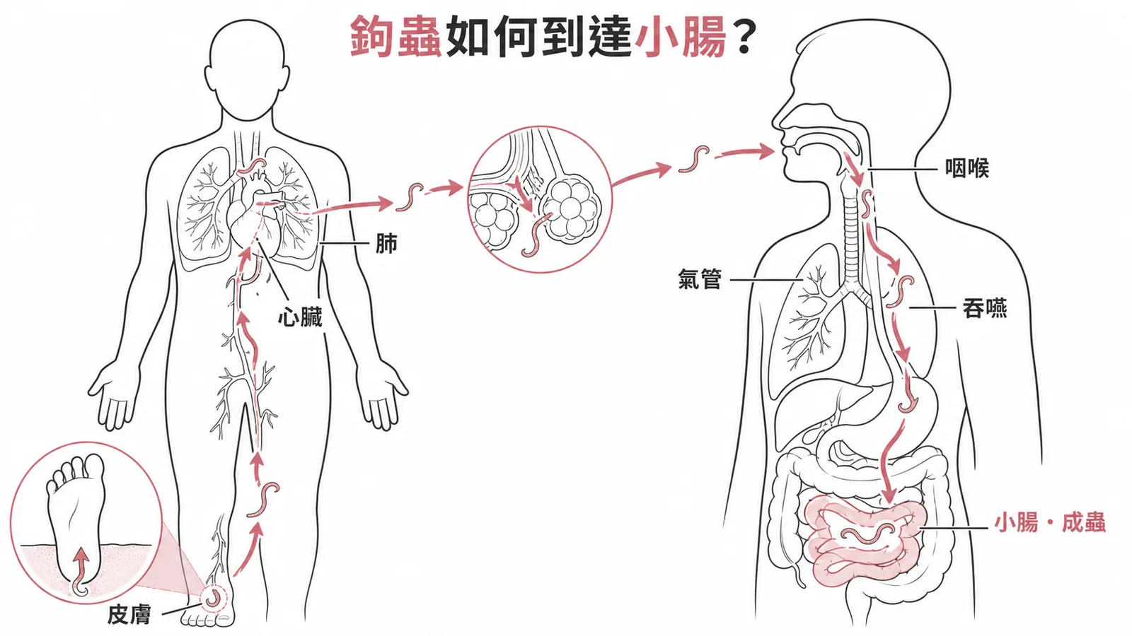 十二指腸鉤蟲心肺移行路徑：皮膚→心臟→肺→氣管→咽喉→小腸成蟲