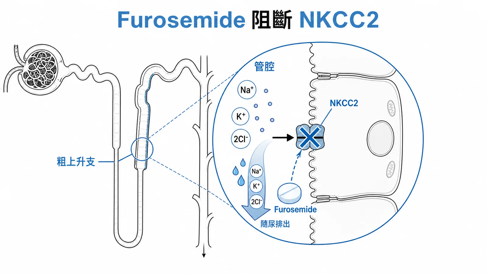Furosemide在亨利氏環粗上升支阻斷NKCC2的利尿機轉