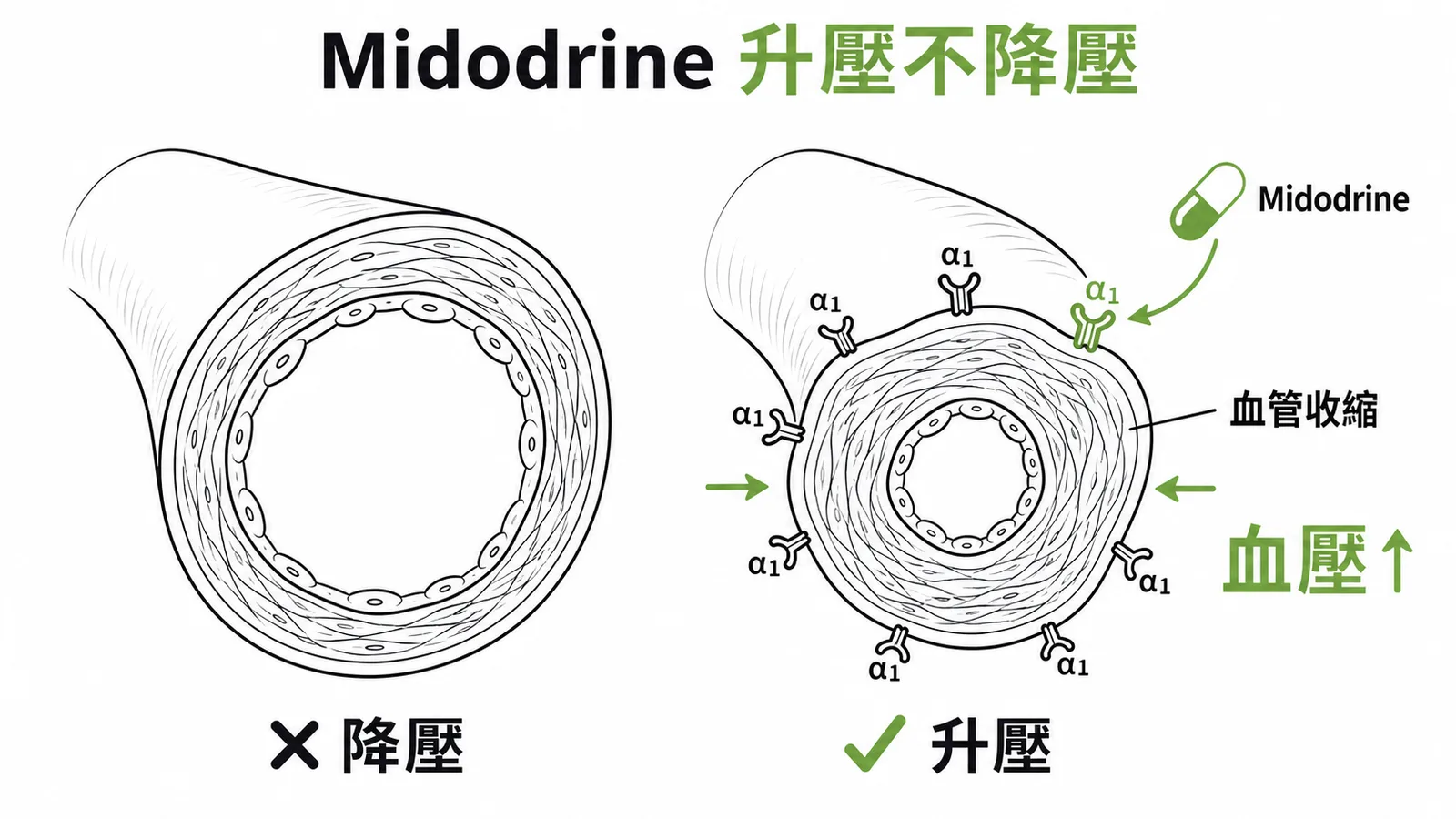 Midodrine活化α1受體使血管收縮升壓而非降壓