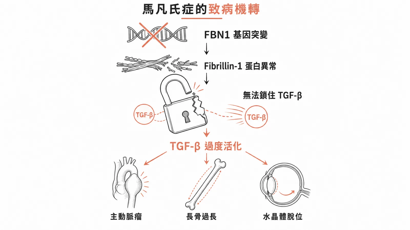 馬凡氏症FBN1突變致TGF-β過度活化機轉圖