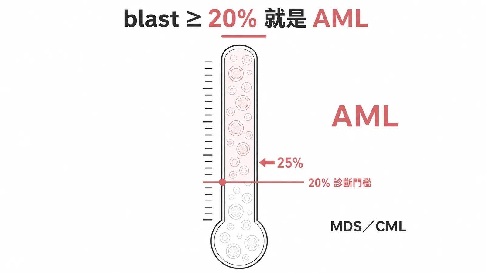 骨髓母細胞佔比20%為AML診斷門檻的示意圖
