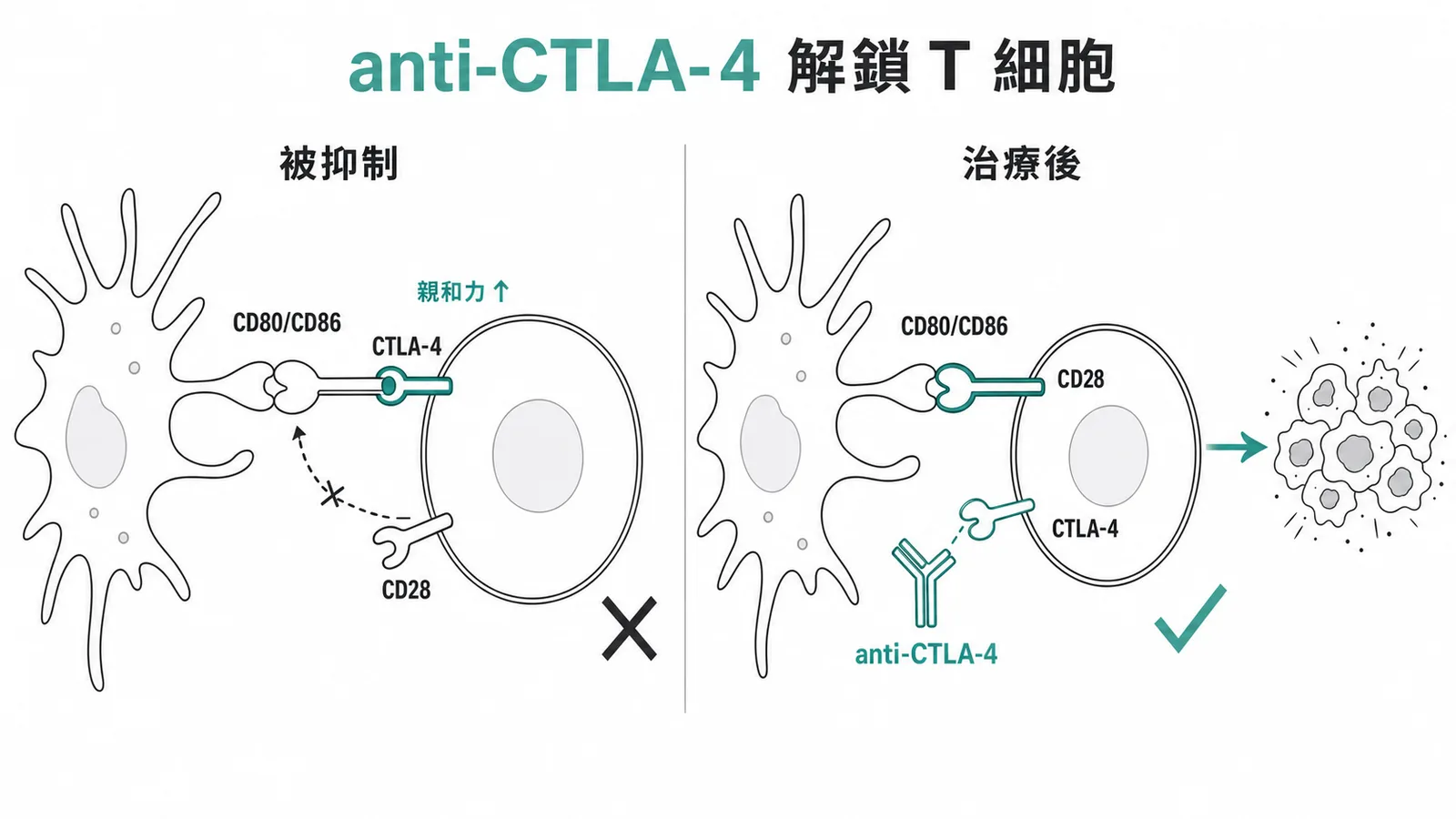 anti-CTLA-4阻斷CTLA-4與CD80/CD86結合,讓CD28重新活化T細胞攻擊腫瘤