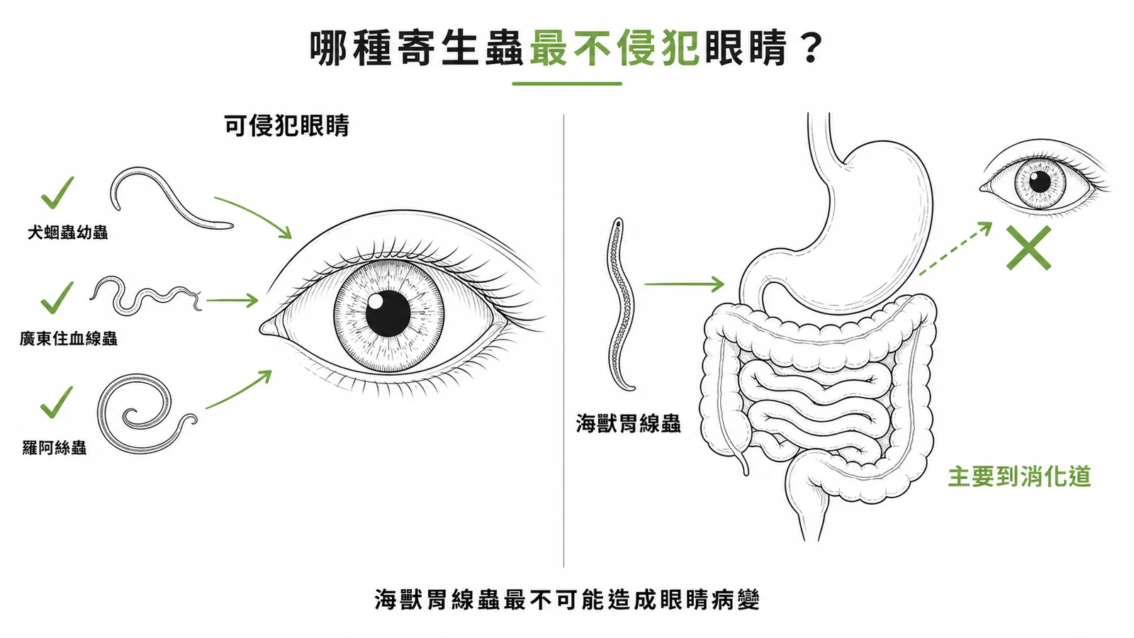 四種寄生蟲與眼部侵犯對比:海獸胃線蟲主要侵犯消化道,最不可能引起眼睛病變