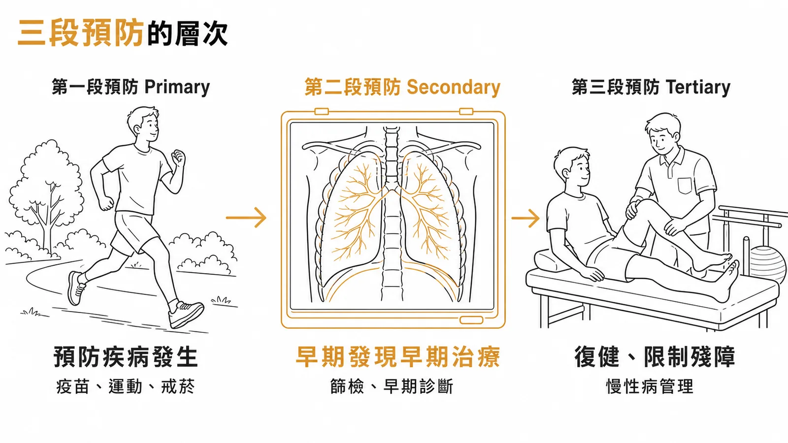 三段預防層次示意:第二段篩檢早期診斷為本題正解