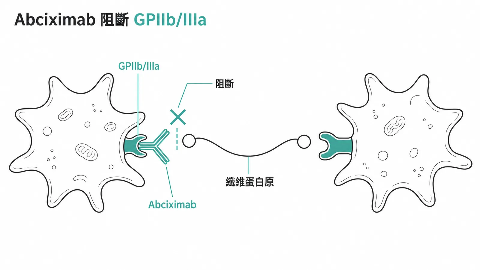 Abciximab抗體阻斷血小板GPIIb/IIIa受體阻止纖維蛋白原橋接凝集