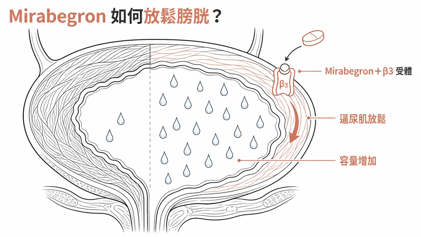 Mirabegron 活化膀胱逼尿肌 β3 受體，使逼尿肌放鬆、膀胱容量增加
