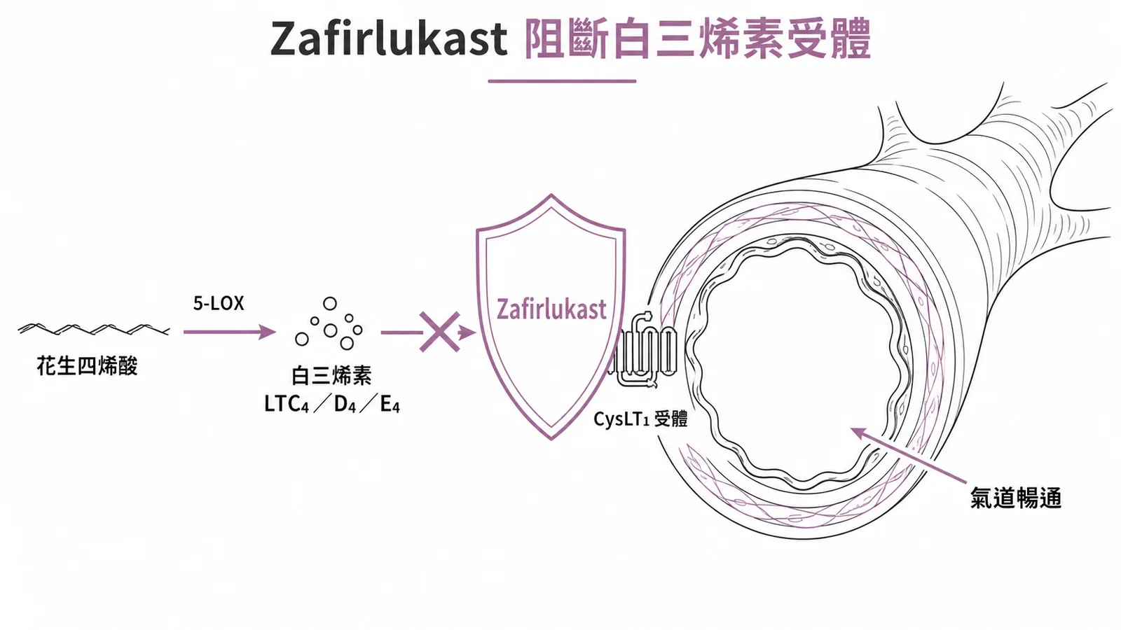 Zafirlukast 阻斷 CysLT1 受體,抑制白三烯素引起的支氣管收縮與發炎