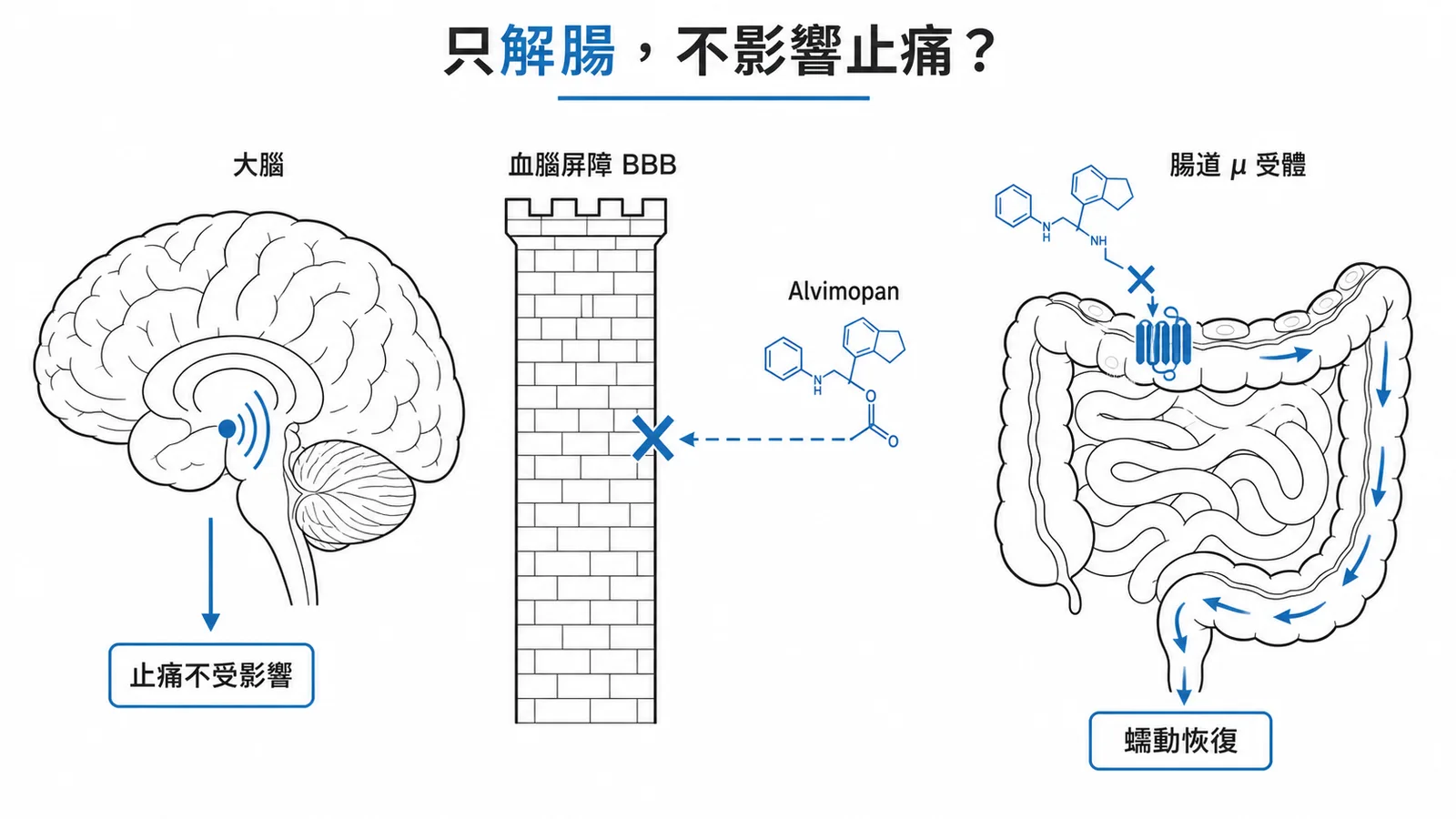 Alvimopan 不穿透血腦屏障，只在腸道拮抗 μ 受體恢復蠕動，不影響中樞止痛
