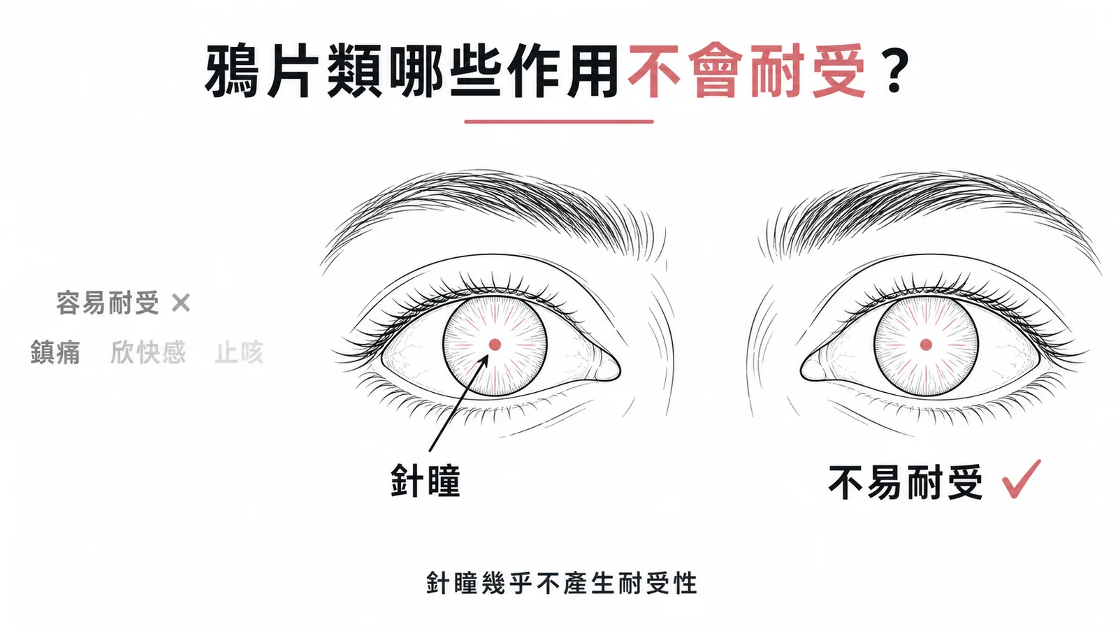 鴉片類藥物中瞳孔縮小(針瞳)幾乎不產生耐受性,為過量標誌