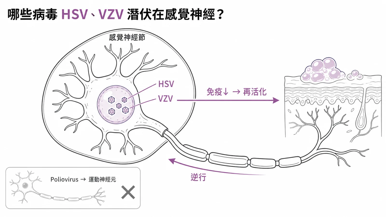 HSV與VZV潛伏在感覺神經節，免疫下降時再活化復發