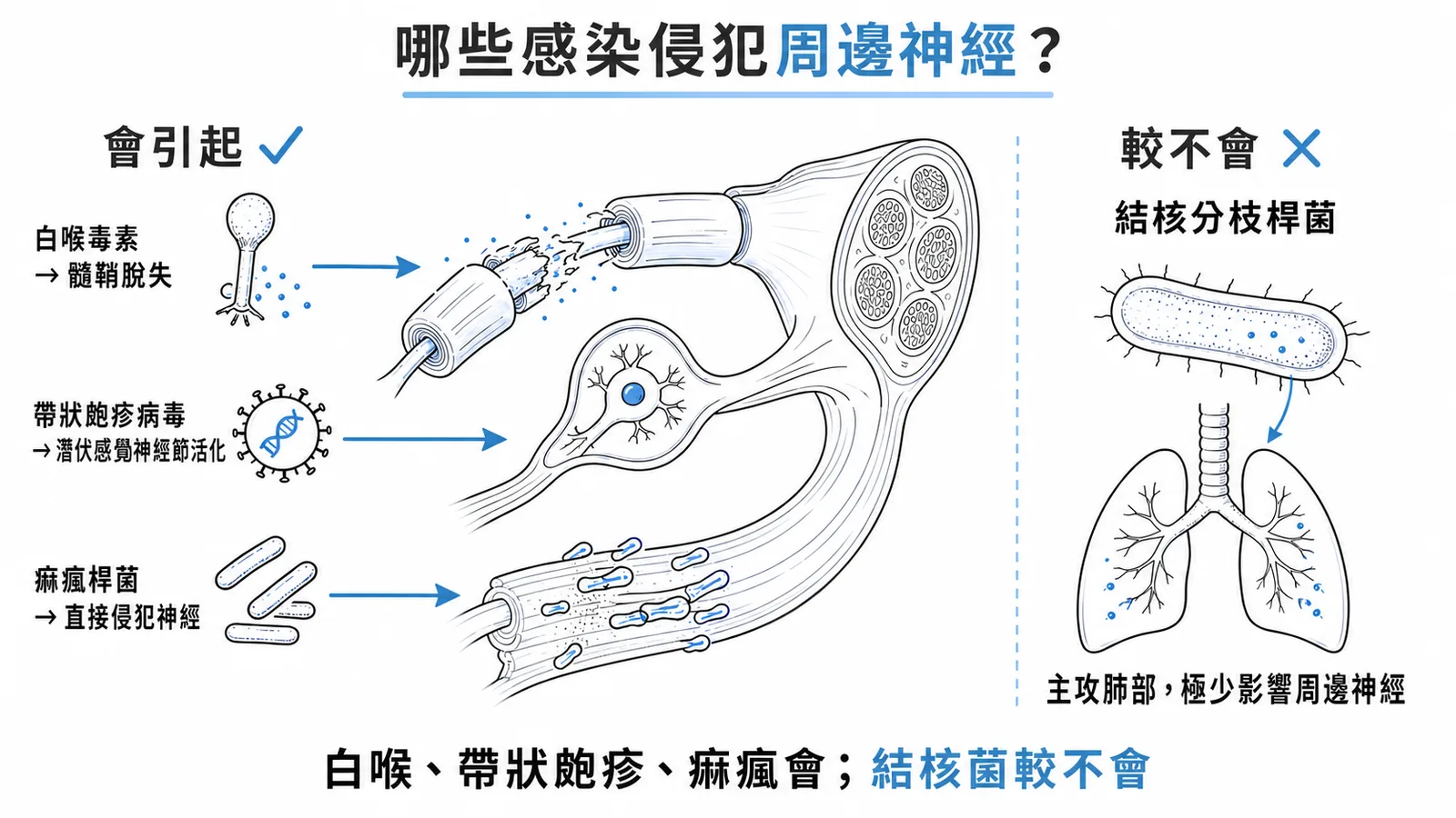 白喉帶狀皰疹痲瘋會引起周邊神經病變但結核菌較不會