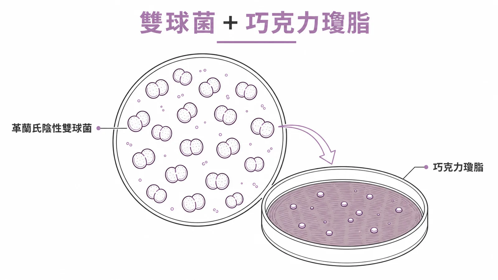 淋病雙球菌鑑定:革蘭氏陰性雙球菌搭配巧克力瓊脂培養