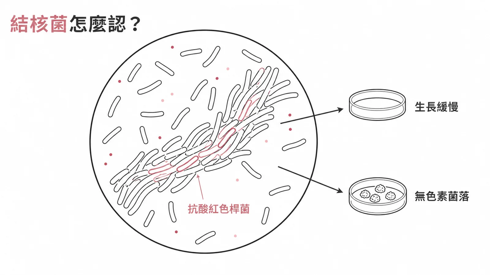 結核分枝桿菌鑑定特徵:抗酸性紅色桿菌聚集、生長緩慢、無色素菌落
