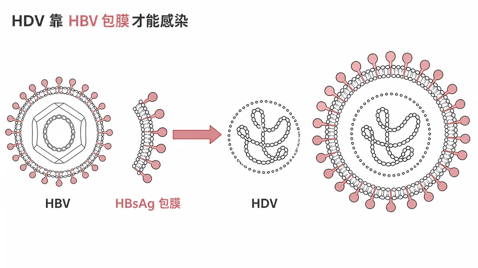 HDV需要HBV的HBsAg包膜才能組裝成感染性病毒的示意圖
