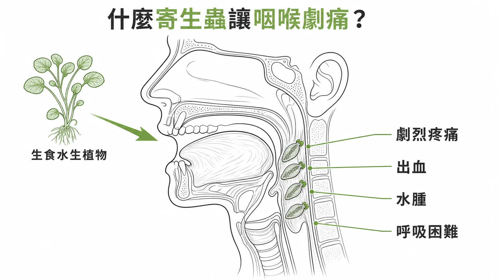 牛羊肝吸蟲幼蟲附著咽喉引起halzoun的感染途徑與症狀