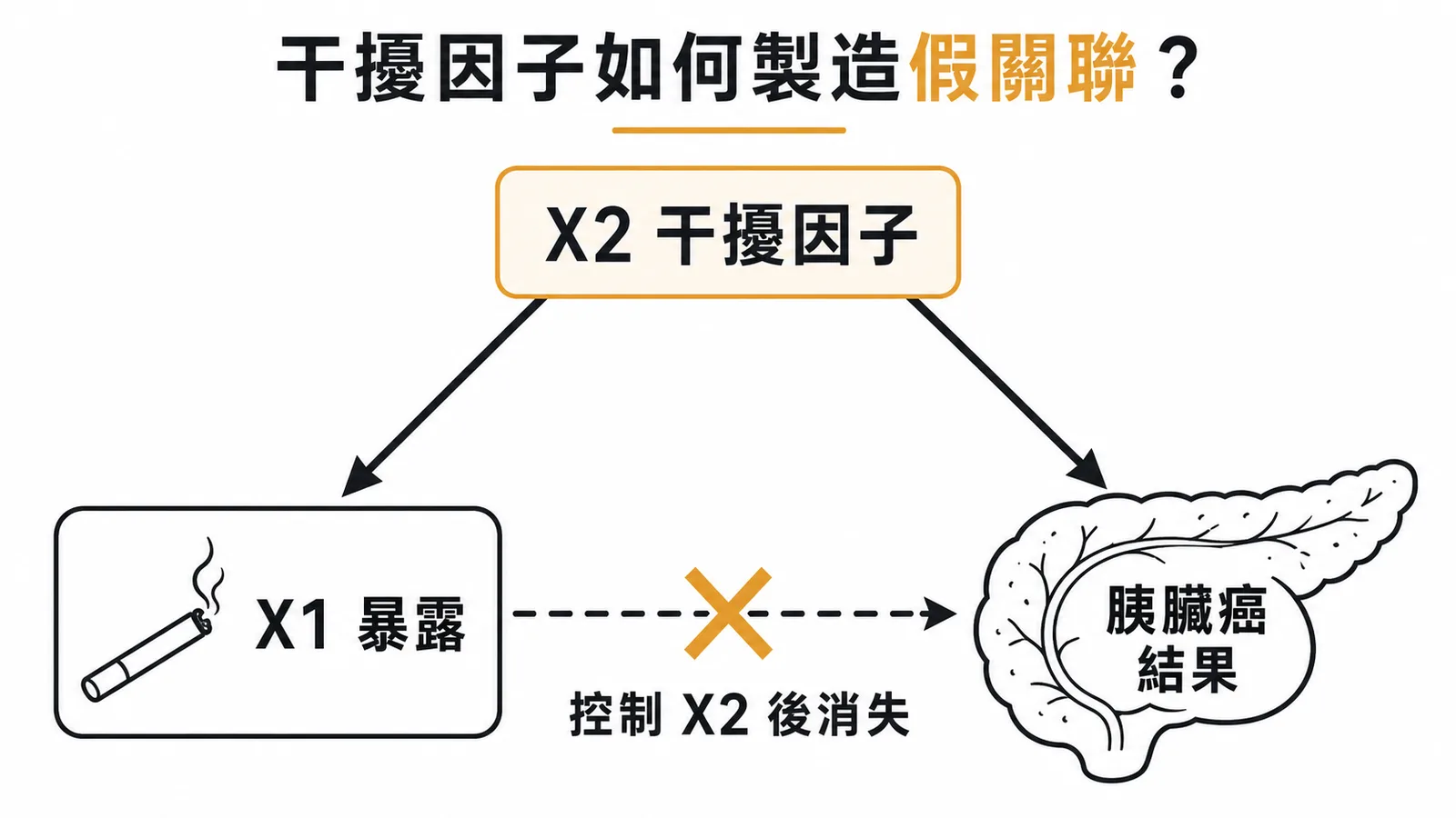干擾因子三角關係：X2同時關聯暴露與結果製造假關聯