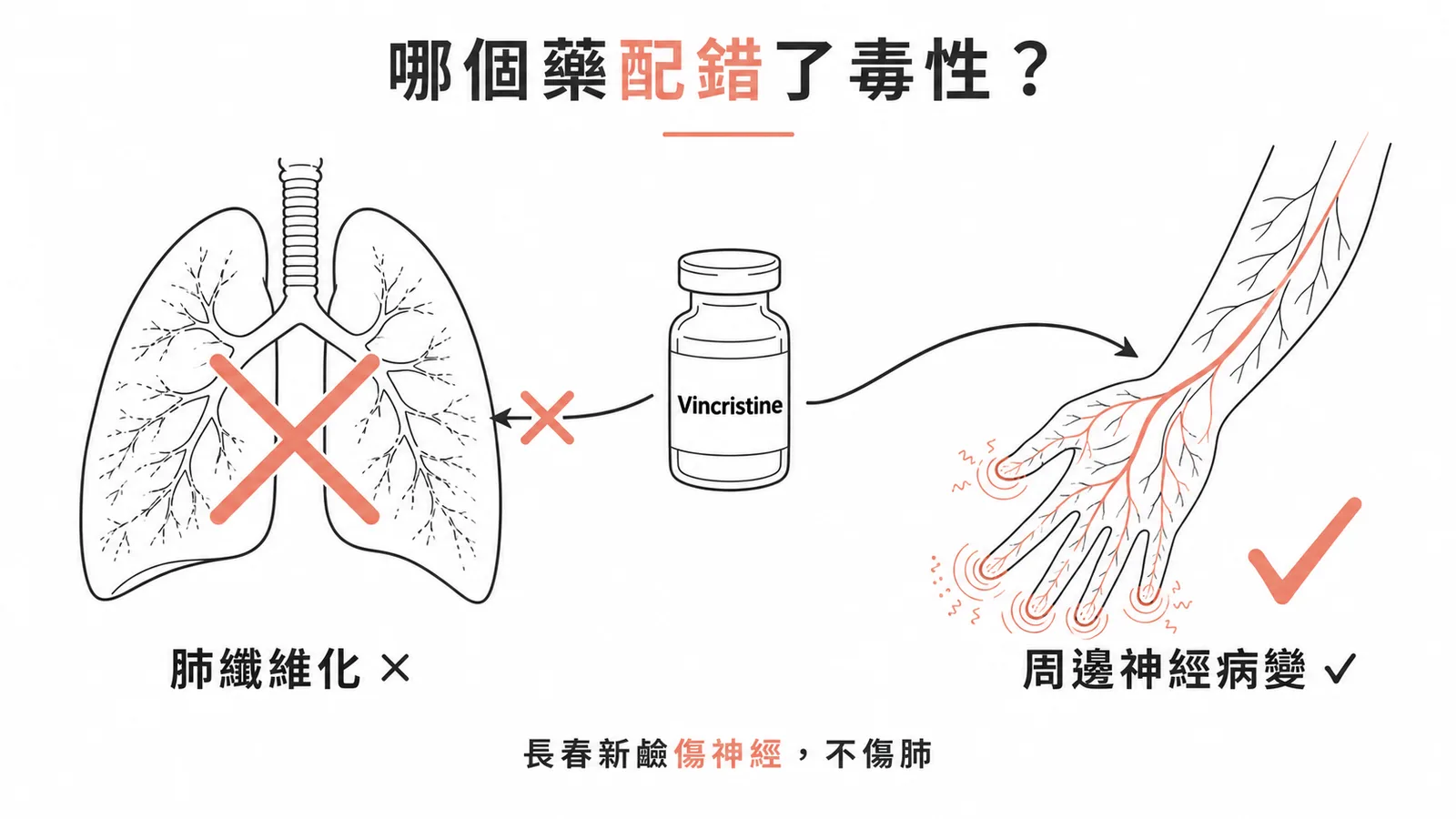 Vincristine毒性是周邊神經病變而非肺纖維化