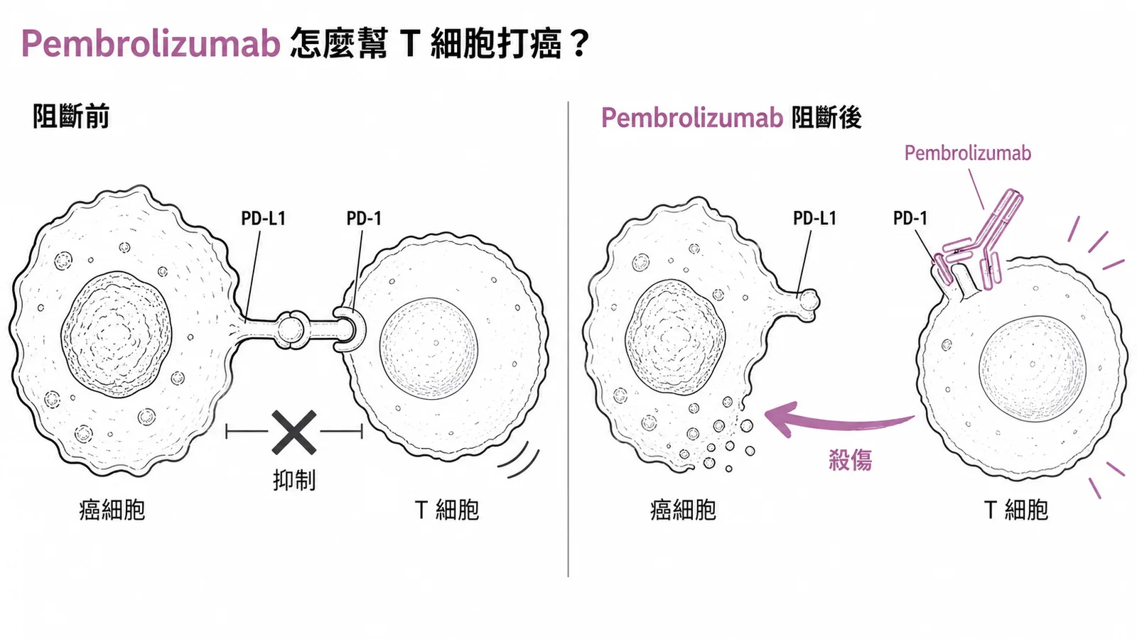 Pembrolizumab 阻斷 PD-1 讓 T 細胞重新攻擊癌細胞的機制示意圖
