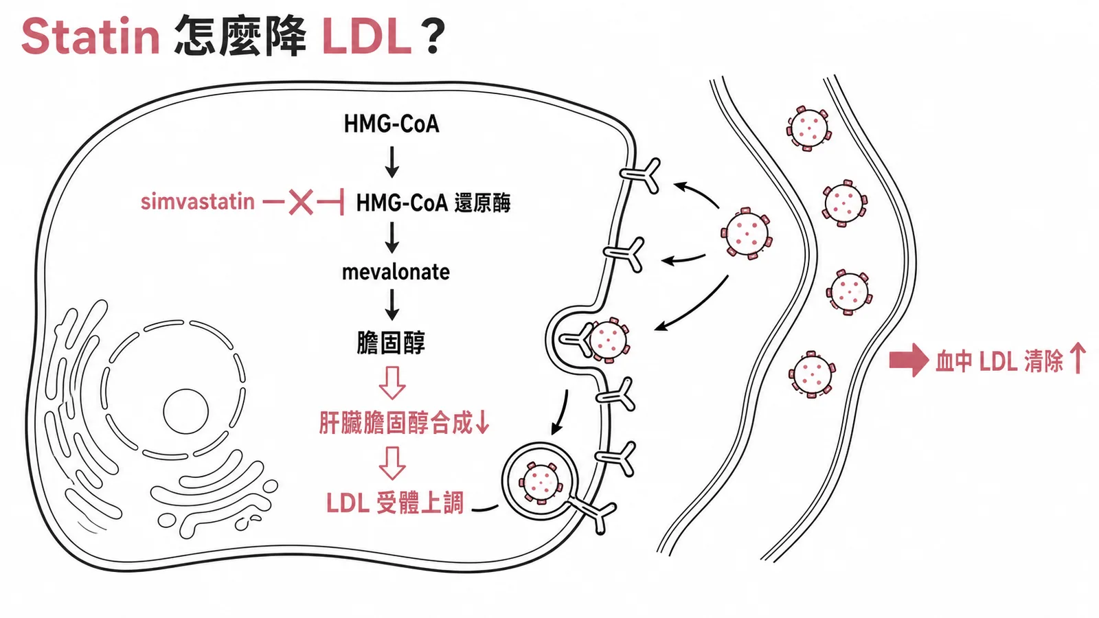 Simvastatin 抑制 HMG-CoA 還原酶降低膽固醇合成並上調 LDL 受體的機制