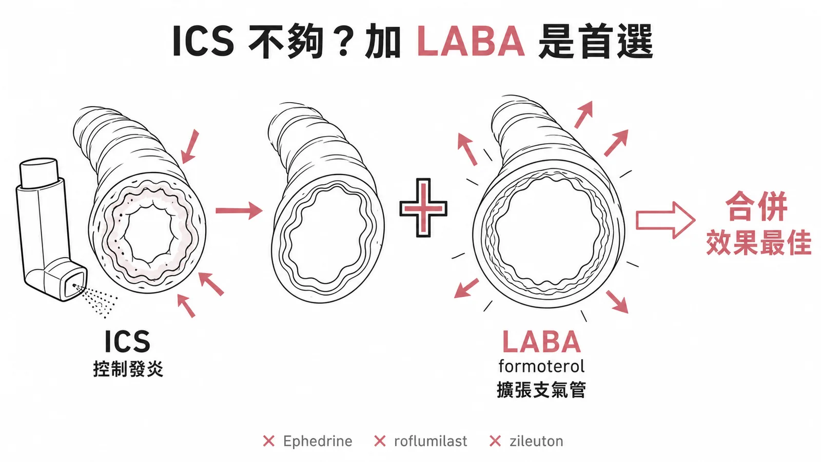 ICS 控制發炎加上 LABA formoterol 擴張支氣管的氣喘階梯治療示意圖