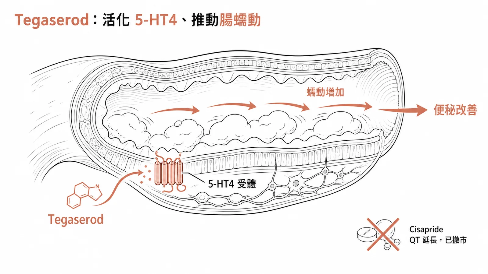 Tegaserod 活化腸壁 5-HT4 受體促進蠕動治療便秘型腸躁症的示意圖