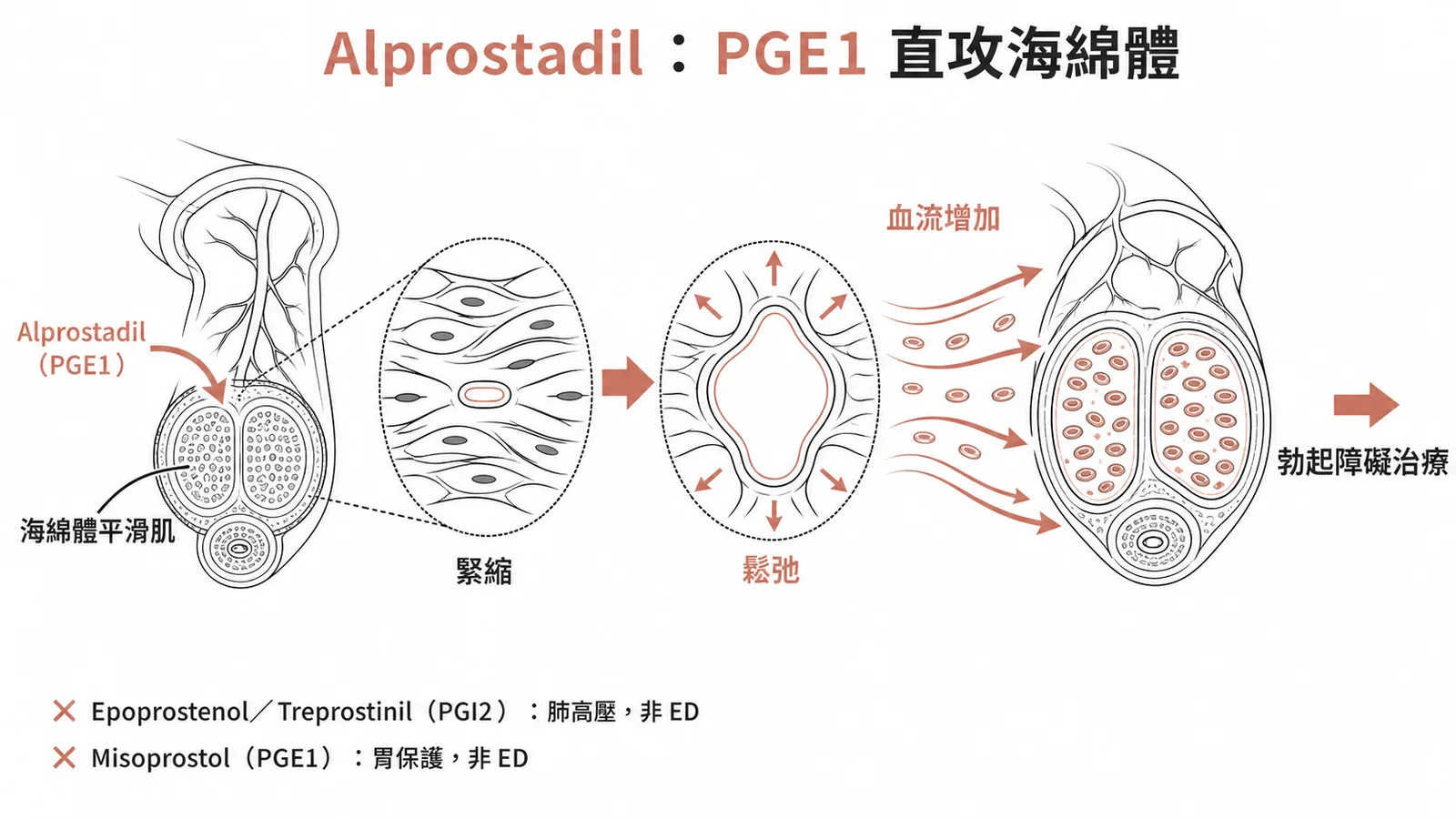 Alprostadil 作用於海綿體平滑肌使其鬆弛增加血流的藥理機轉示意圖
