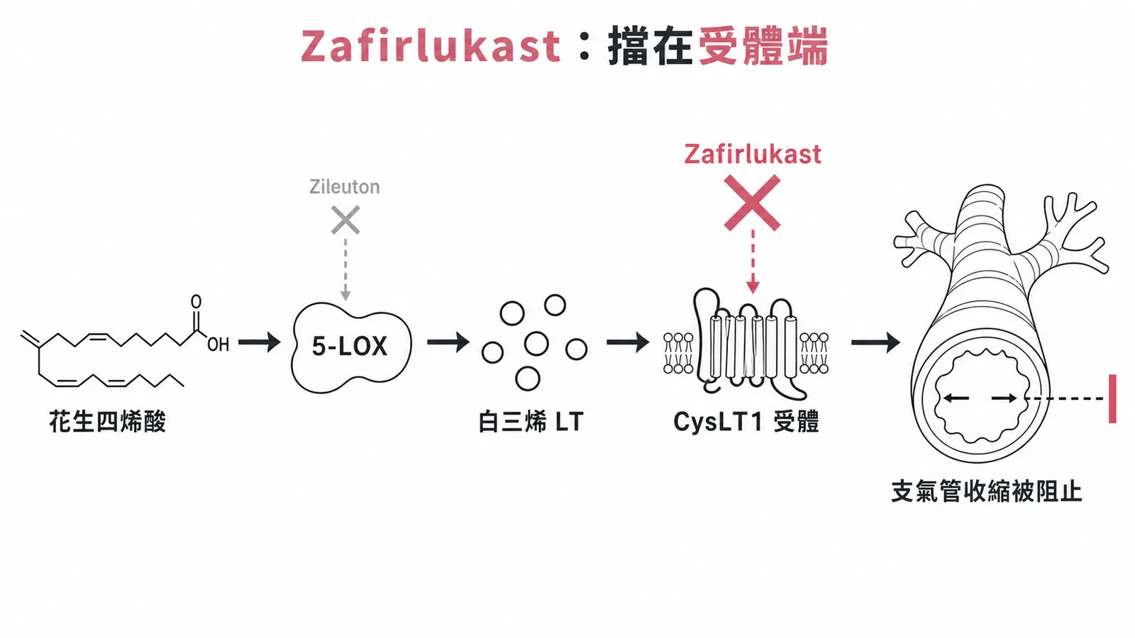 白三烯途徑中 Zafirlukast 阻斷 CysLT1 受體與 Zileuton 抑制 5-LOX 的兩個阻斷點示意圖