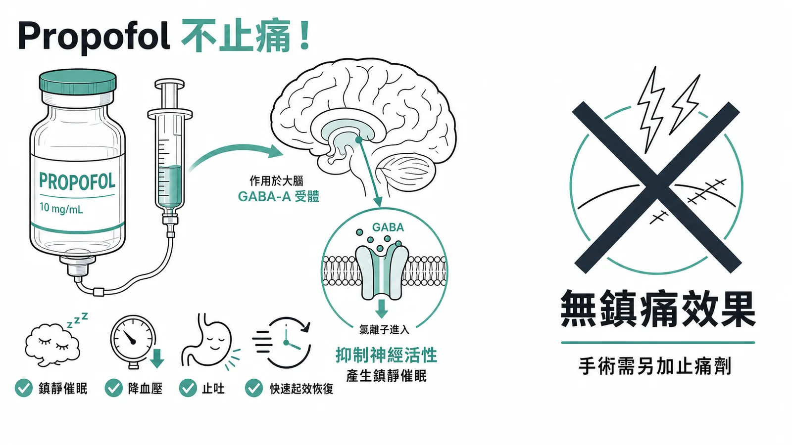 Propofol 不止痛:左側列出鎮靜催眠、降血壓、止吐、快速起效等四大作用,右側以大叉標示無鎮痛效果
