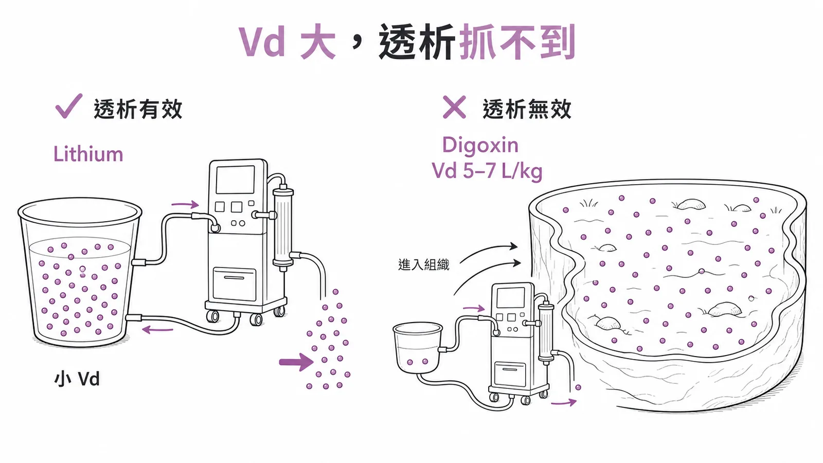 Vd 大透析抓不到:Lithium 小 Vd 透析有效 vs Digoxin Vd 5-7 L/kg 藥物散入組織透析無效