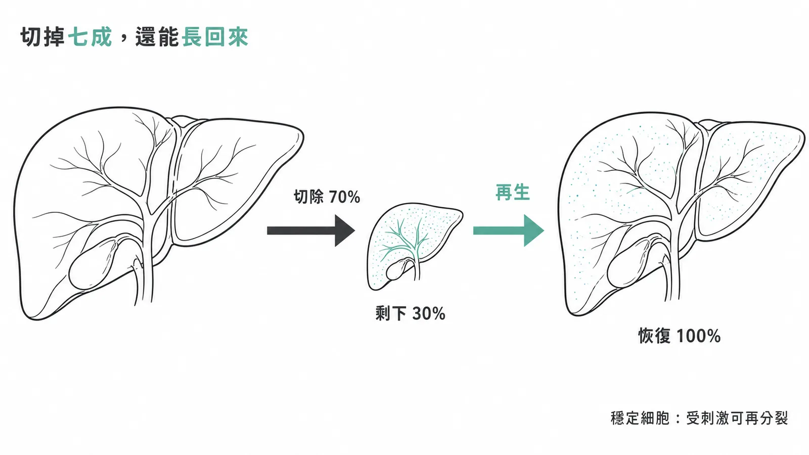 切掉七成還能長回來：肝臟切除 70% 後剩餘 30% 可再生恢復至 100%，因肝細胞屬穩定細胞受刺激可再分裂