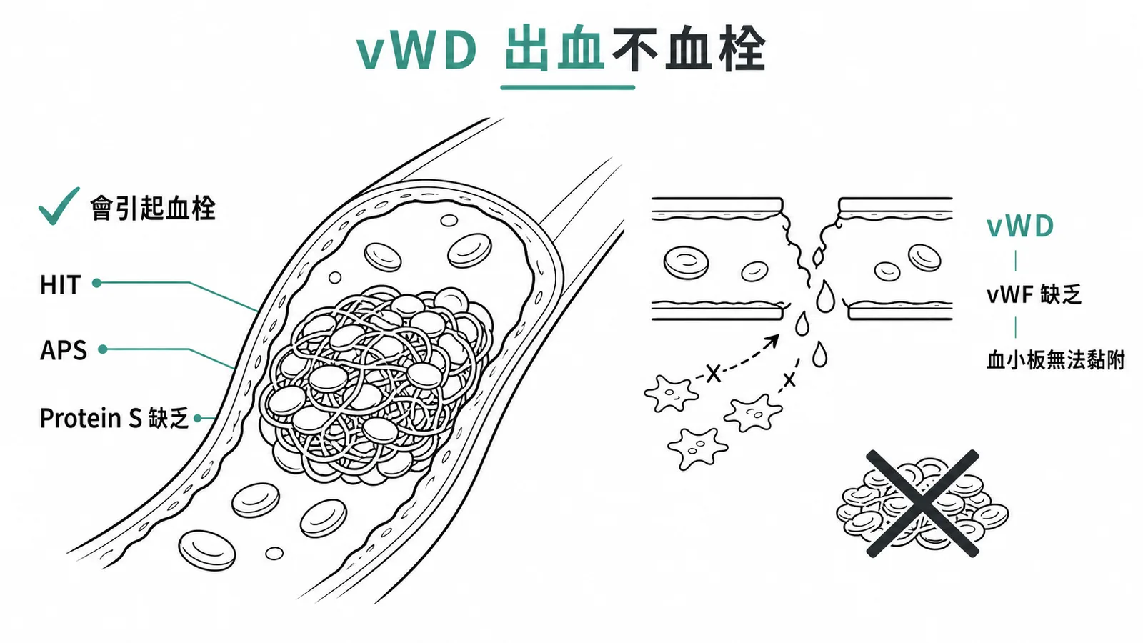 vWD 出血不血栓：HIT、APS、Protein S 缺乏引起血栓，vWD 因 vWF 缺乏血小板無法黏附導致出血